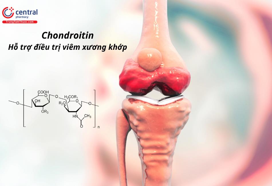 Chondroitin - Hỗ trợ điều trị viêm xương khớp