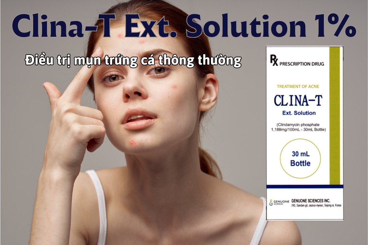 Thuốc Clina-T Ext. Solution 1% điều trị mụn trứng cá mức độ nhẹ đến vừa