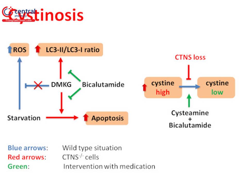 Hình 3: Hội chứng Cystiosis