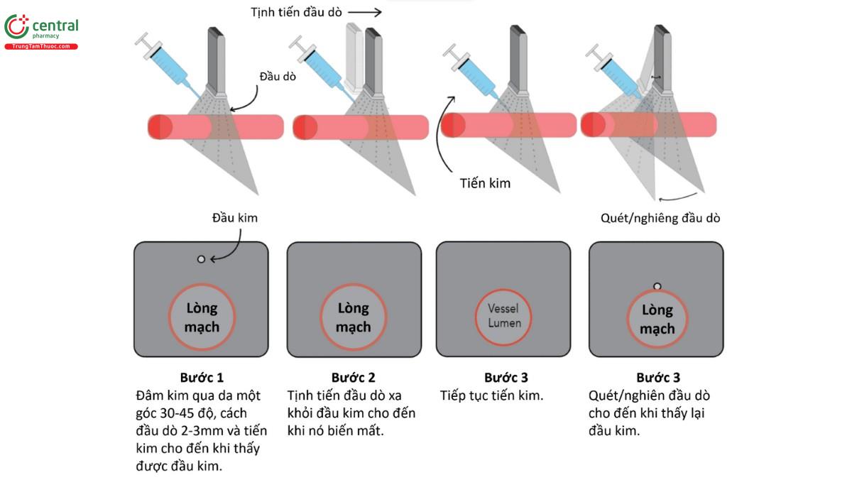Hướng dẫn đi kim bằng phương pháp Creep. Đừg bao giờ để mất đầu kim