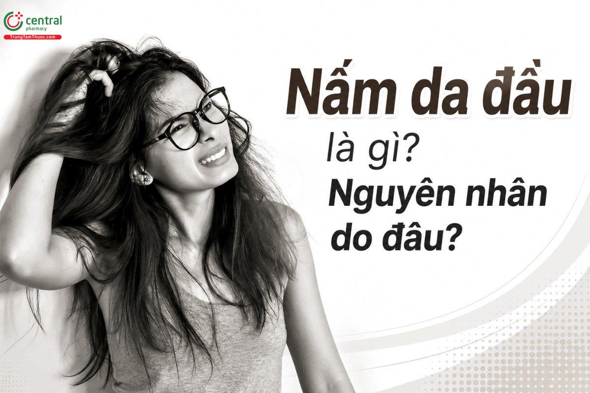Nấm da đầu là gì? Nguyên nhân do đâu?