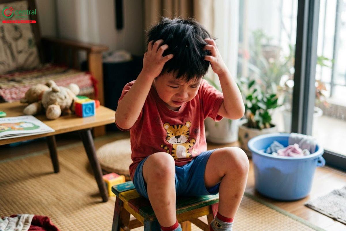 Dấu hiệu và triệu chứng khi bị chấy cắn.