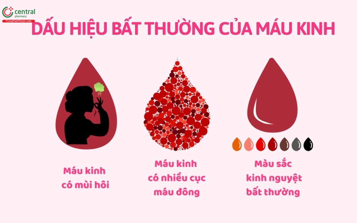 Dấu hiệu kinh bất thường