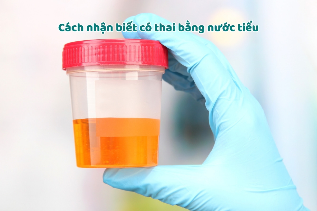 Cách nhận biết có thai bằng nước tiểu
