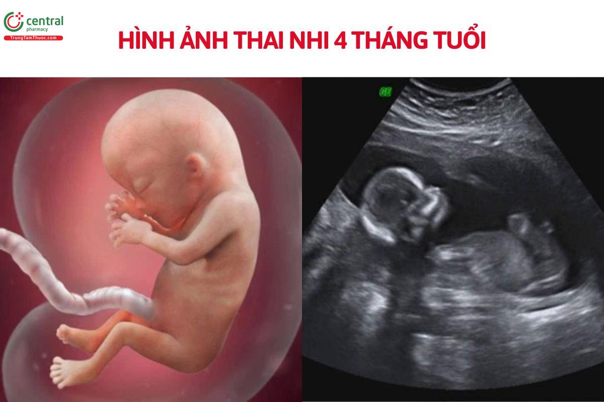 Hình ảnh thai nhi 4 tháng tuổi