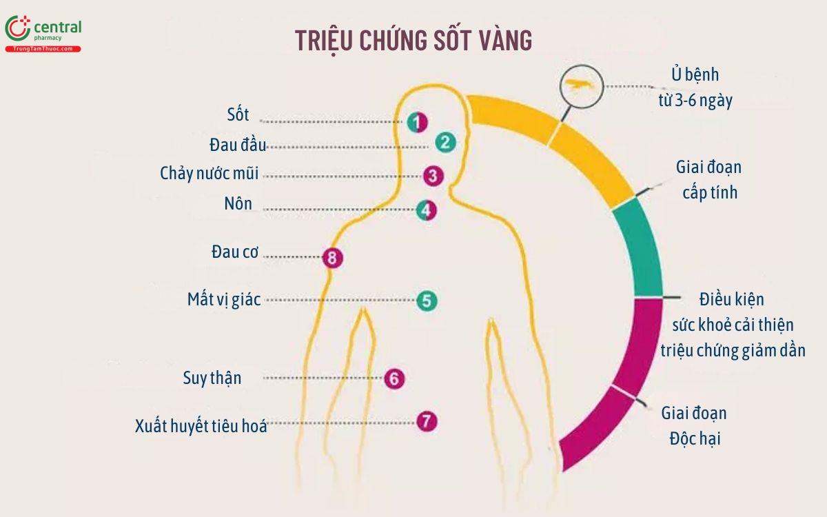 Triệu chứng bệnh sốt vàng