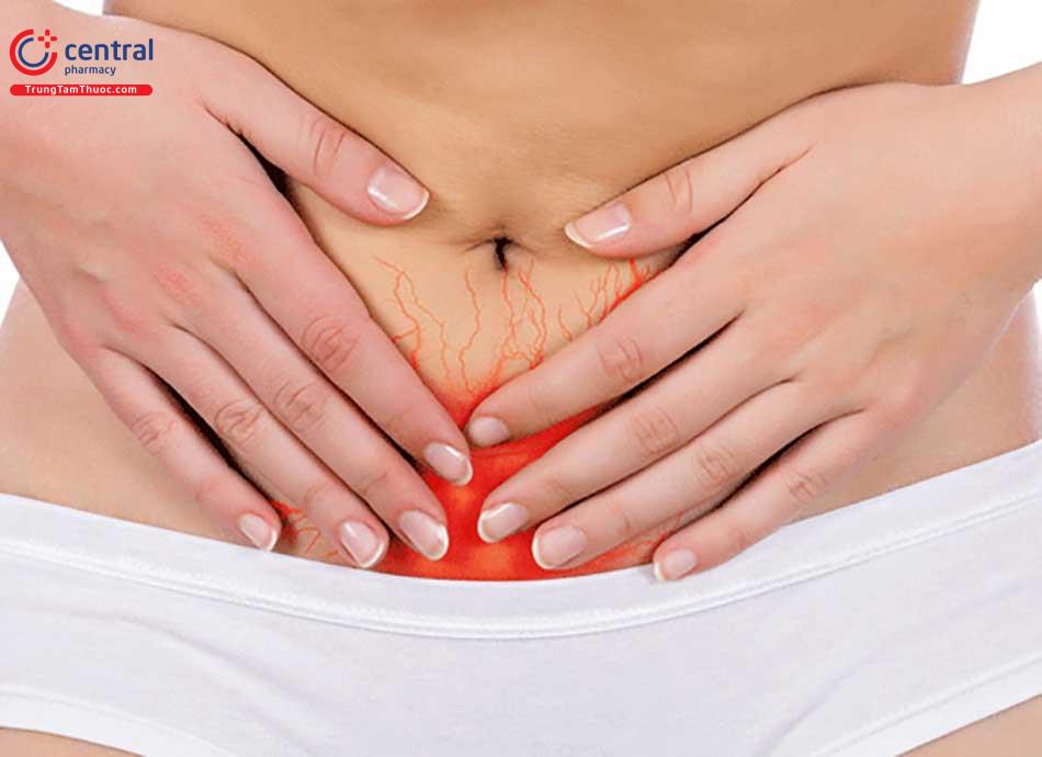 Đau bụng dưới âm ỉ có thể là dấu hiệu của u xơ tử cung
