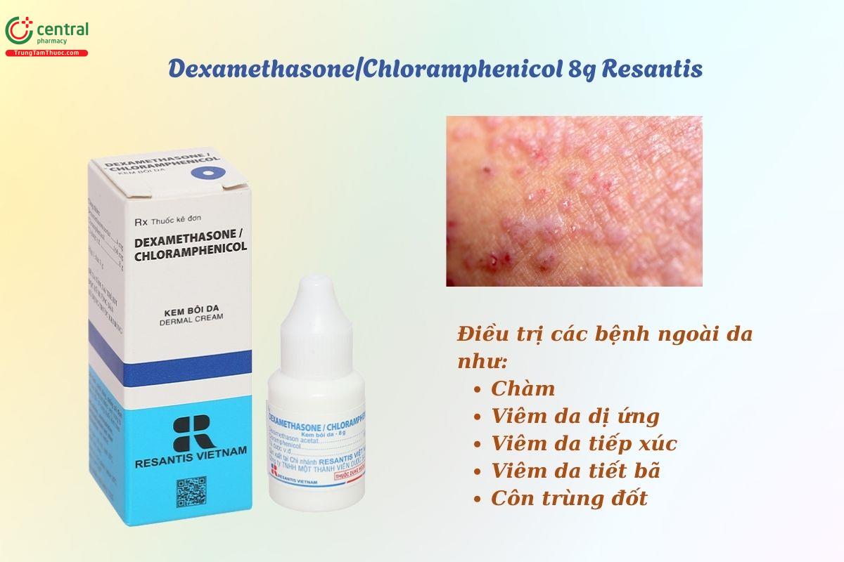 Thuốc Dexamethasone/chloramphenicol 8g Resantis trị chàm, viêm da