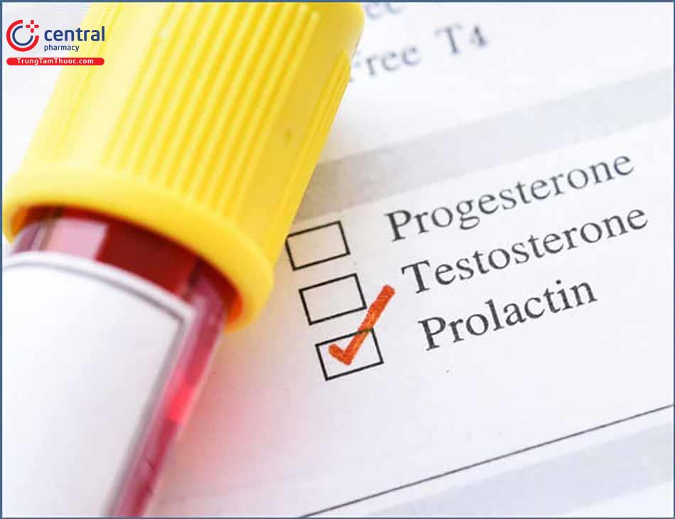 Điều trị u tăng tiết prolactin như thế nào?