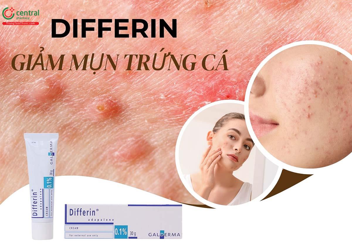 Differin cream dùng cho da gì? Trị mụn gì?