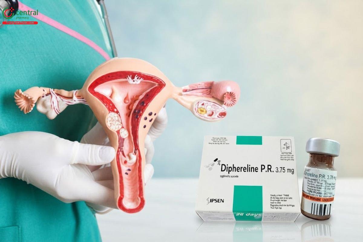 Diphereline P.R 3,75mg xuất xứ Pháp