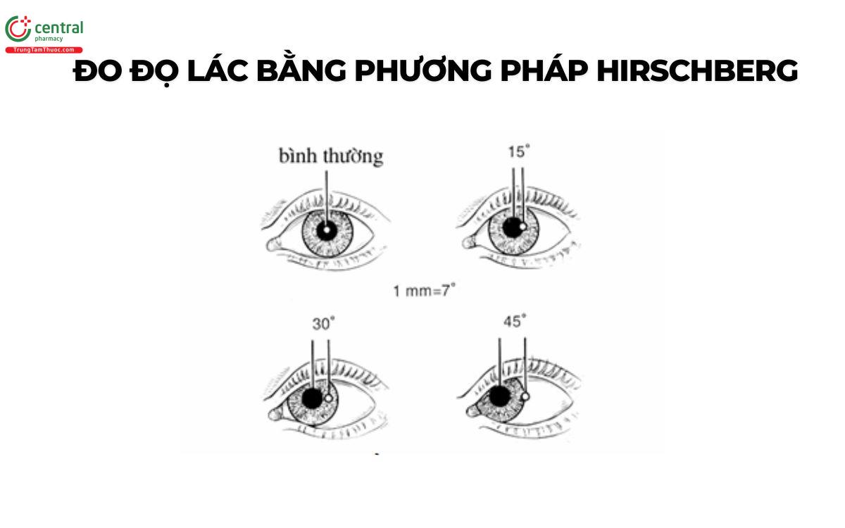 Phương pháp đo độ lác