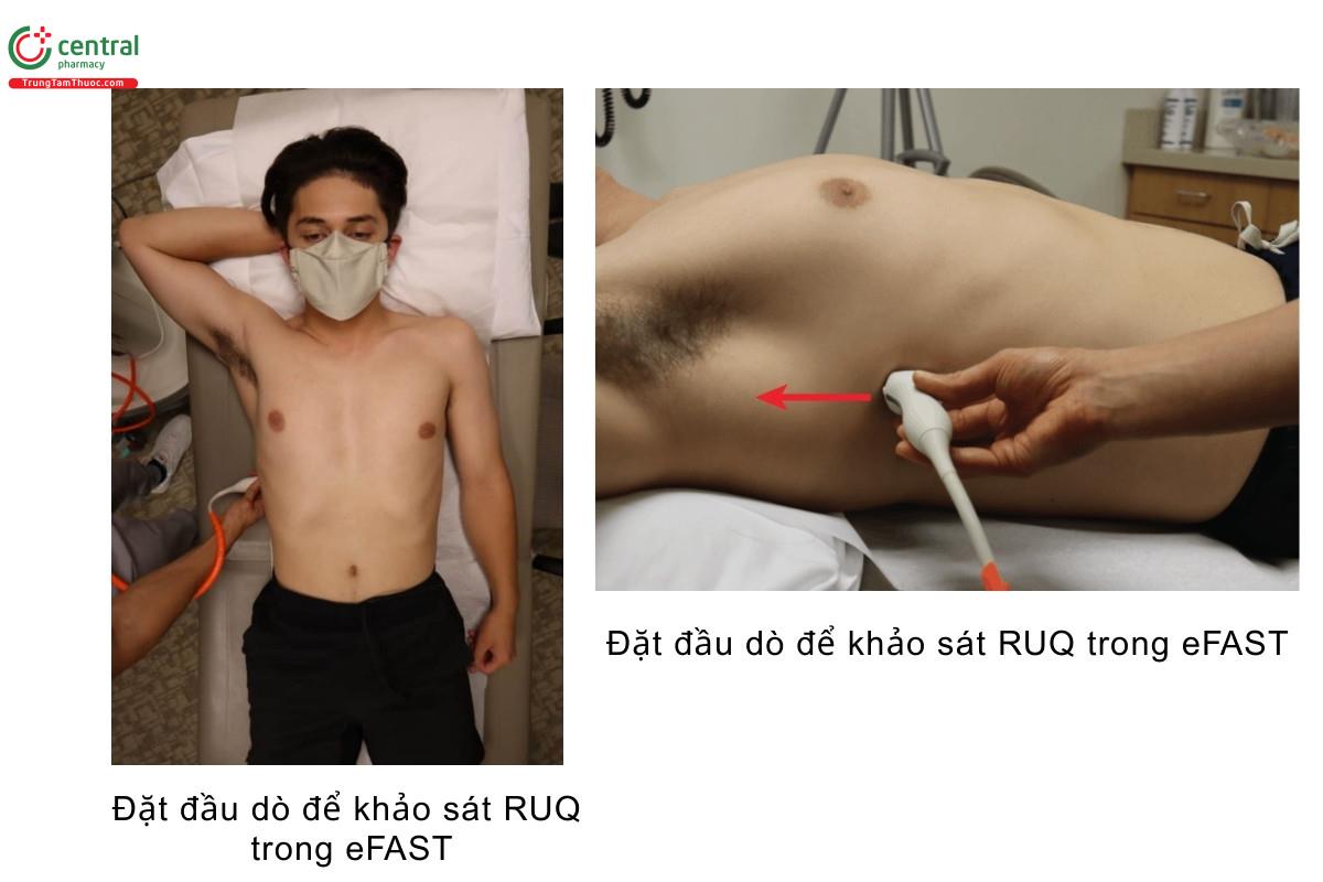 Đặt đầu dò