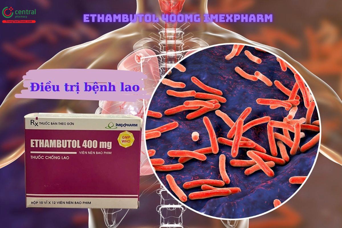 Thuốc Ethambutol 400mg Imexpharm - Điều trị bệnh lao mới và tái phát