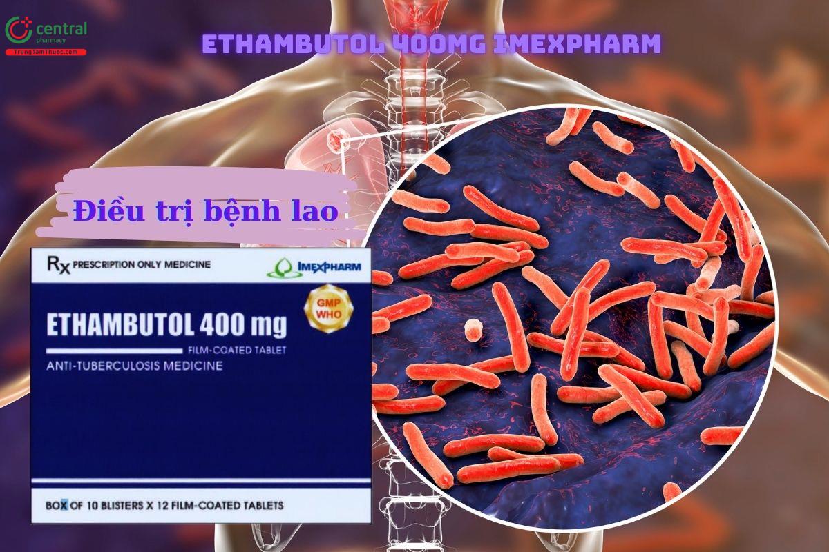 Thuốc Ethambutol 400mg Imexpharm - Điều trị bệnh lao mới và tái phát