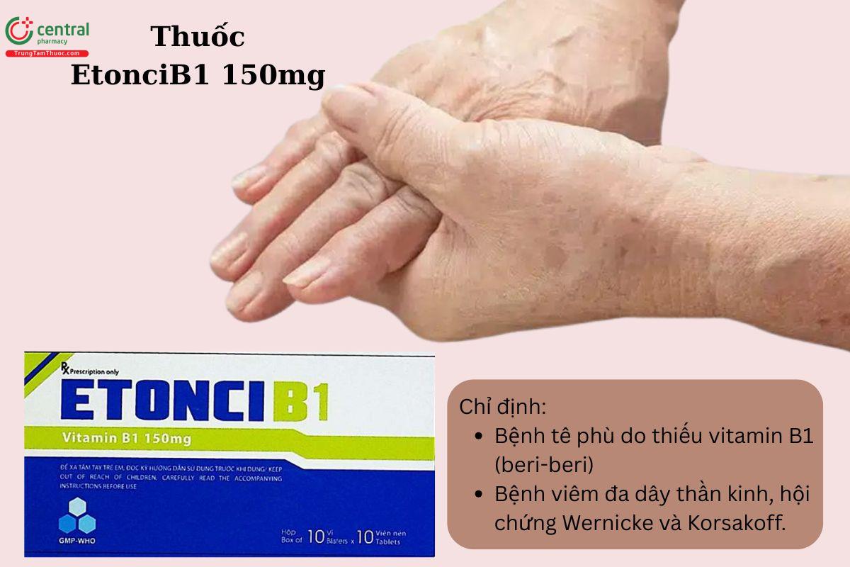 Chỉ định của thuốc EtonciB1 150mg