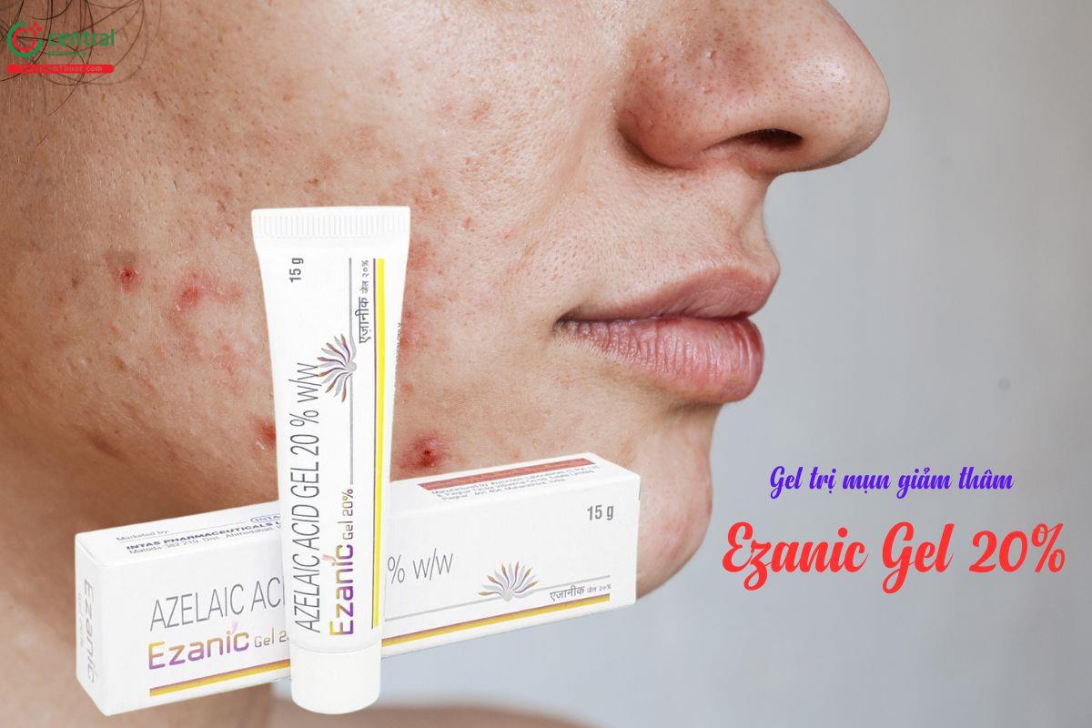 Ezanic Gel 20% Azelaic Acid trị mụn, giảm thâm