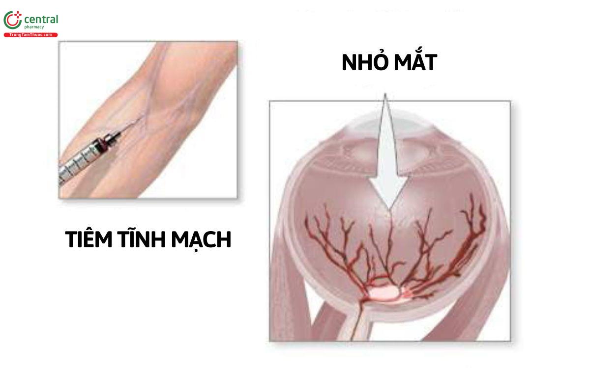 Đường dùng thuốc Fluorescein Sodium