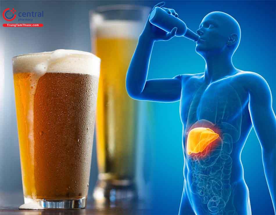 Rượu bia là nguyên nhân gây gan nhiễm mỡ