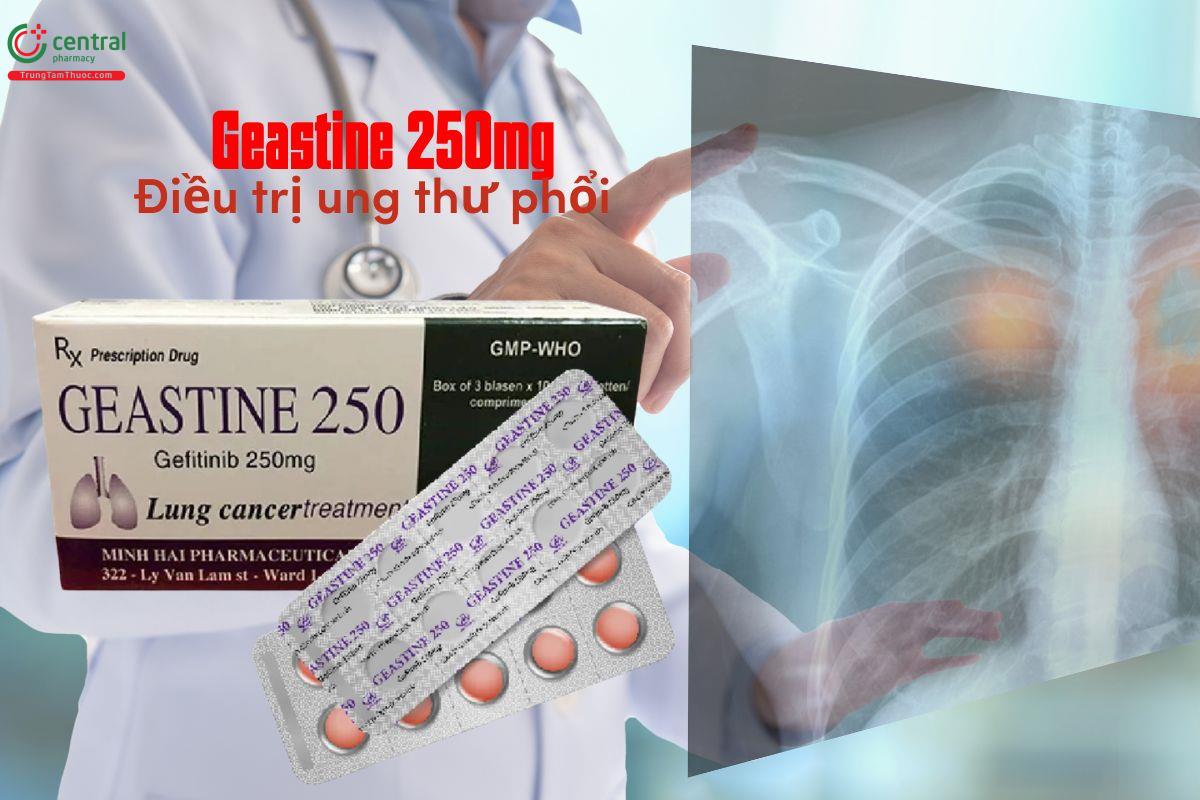 Thuốc Geastine 250mg điều trị cho bệnh nhân ung thư phổi