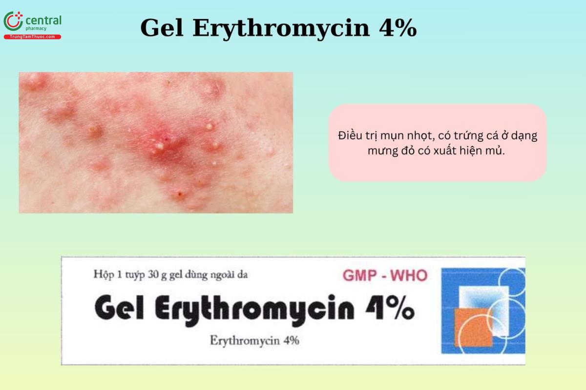 Chỉ định của thuốc Gel Erythromycin 4%