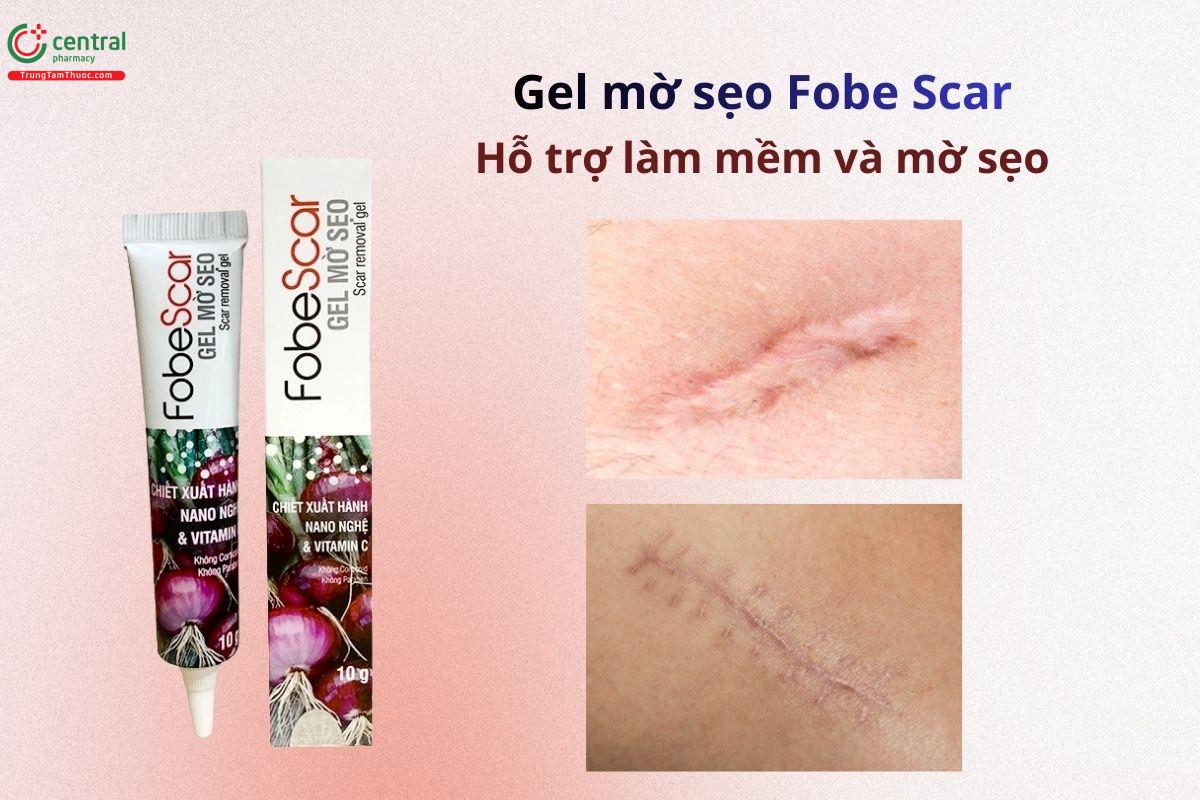 Gel mờ sẹo Fobe Scar hỗ trợ làm mềm và mờ sẹo, vết rạn da