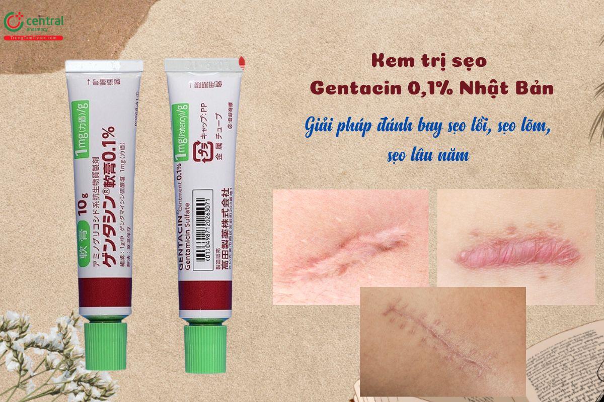 Kem trị sẹo Gentacin 0.1% Nhật Bản - Loại bỏ sẹo lồi, sẹo lõm