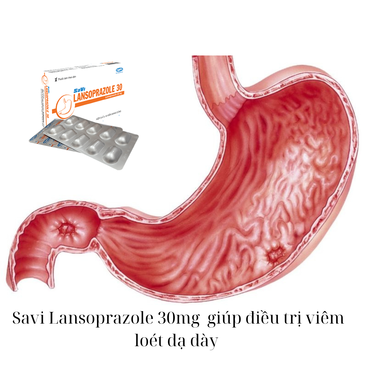  Savi Lansoprazole 30mg chữa viêm loét dạ dày