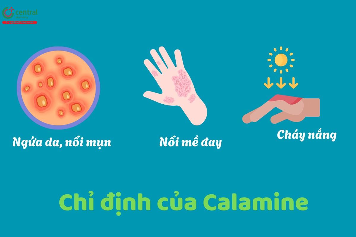 Chỉ định của Calamine