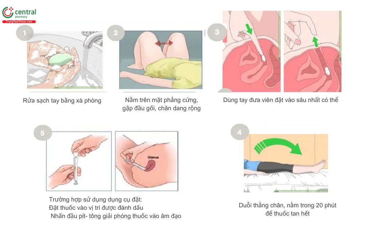 Hướng dẫn đặt viên đặt phụ khoa tại nhà