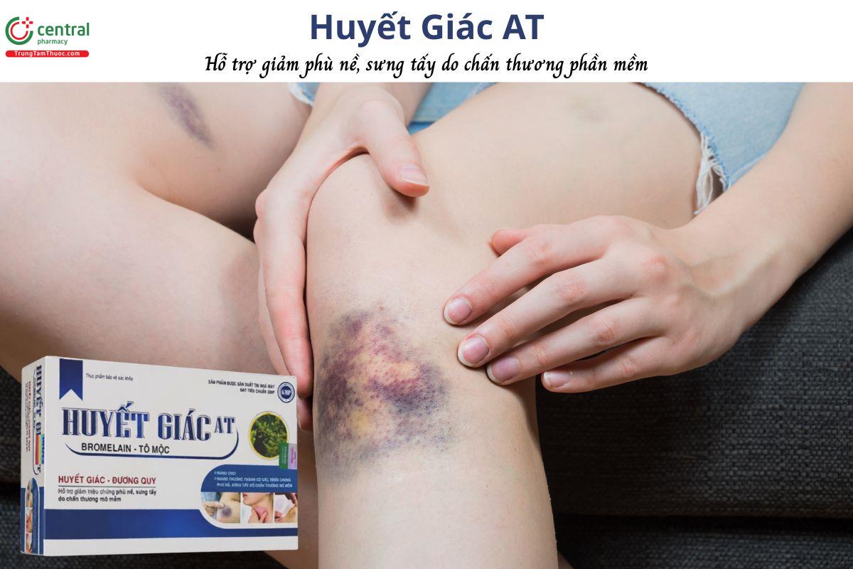 Huyết Giác AT - Hỗ trợ giảm sưng tấy, phù nề do chấn thương mô mềm