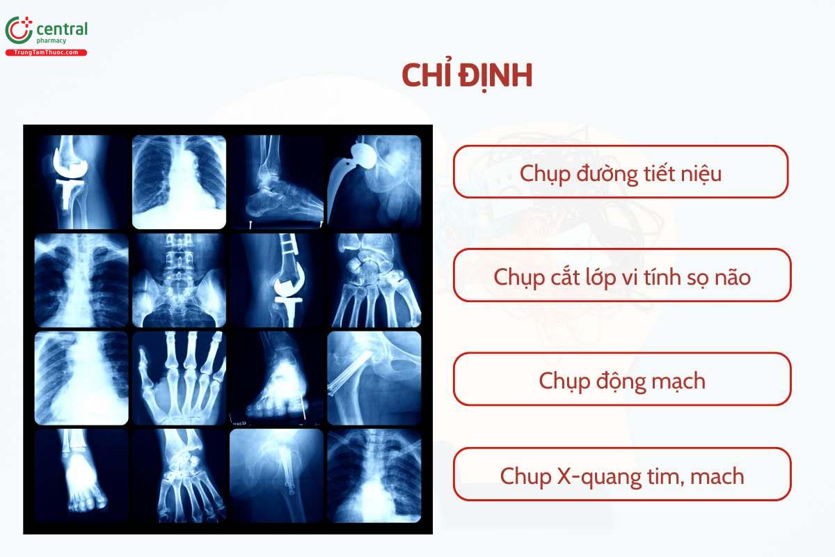 Chỉ định của Iobitridol