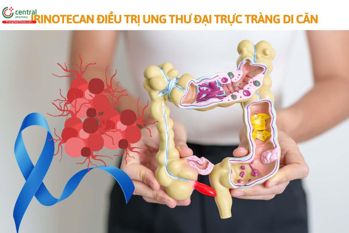 Chỉ định của Irinotecan