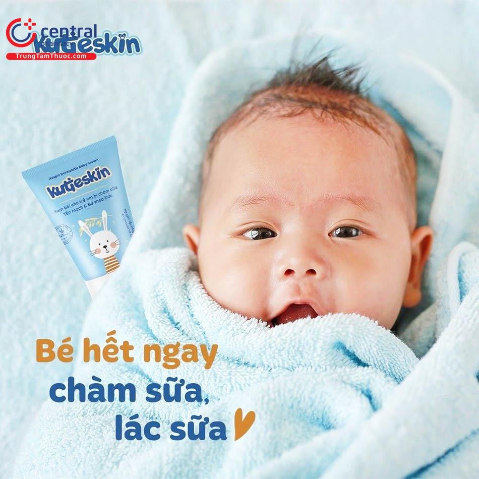 Hinh 3: Kem bôi chàm sữa cho trẻ nhỏ Atopic Dermatitis Baby Cream Kutieskin