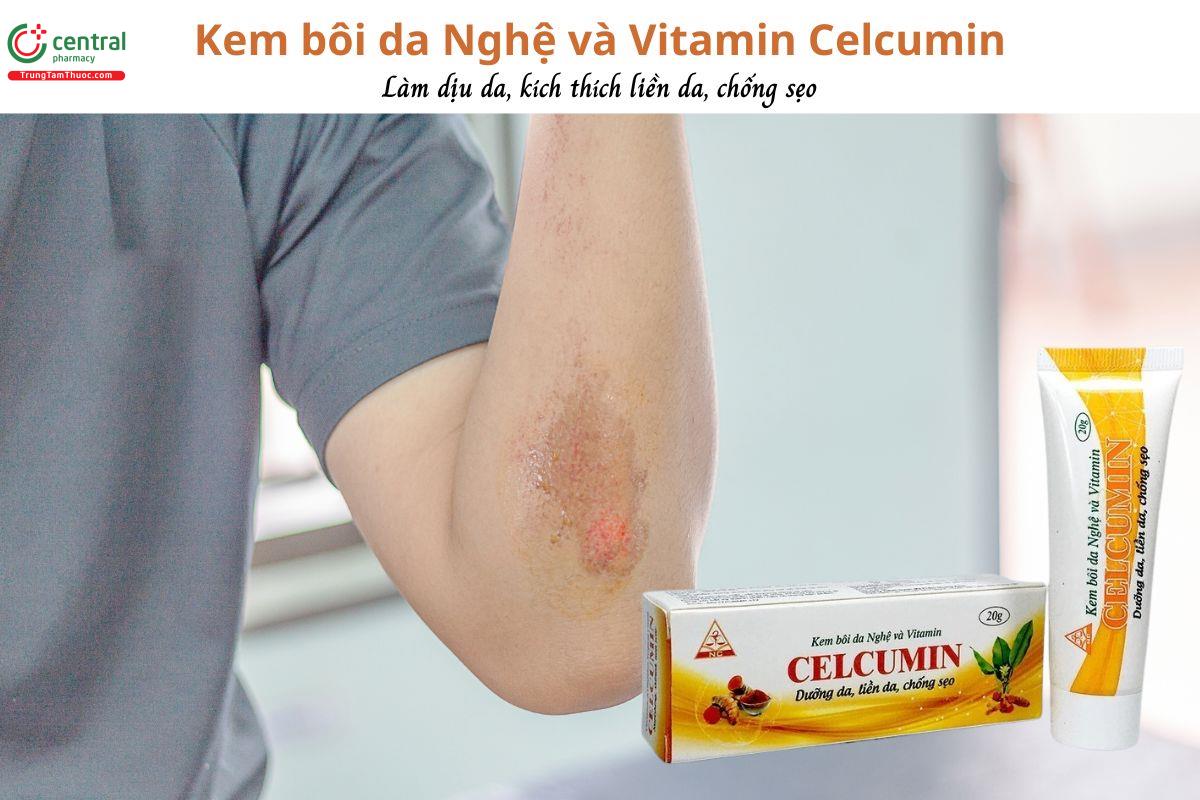 Kem bôi da Nghệ và Vitamin Celcumin - Làm dịu da, dưỡng da, chống sẹo