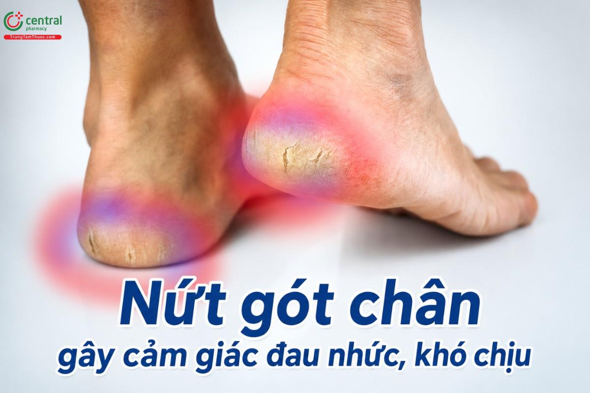 Nứt gót chân gây cảm giác đau nhức, khó chịu