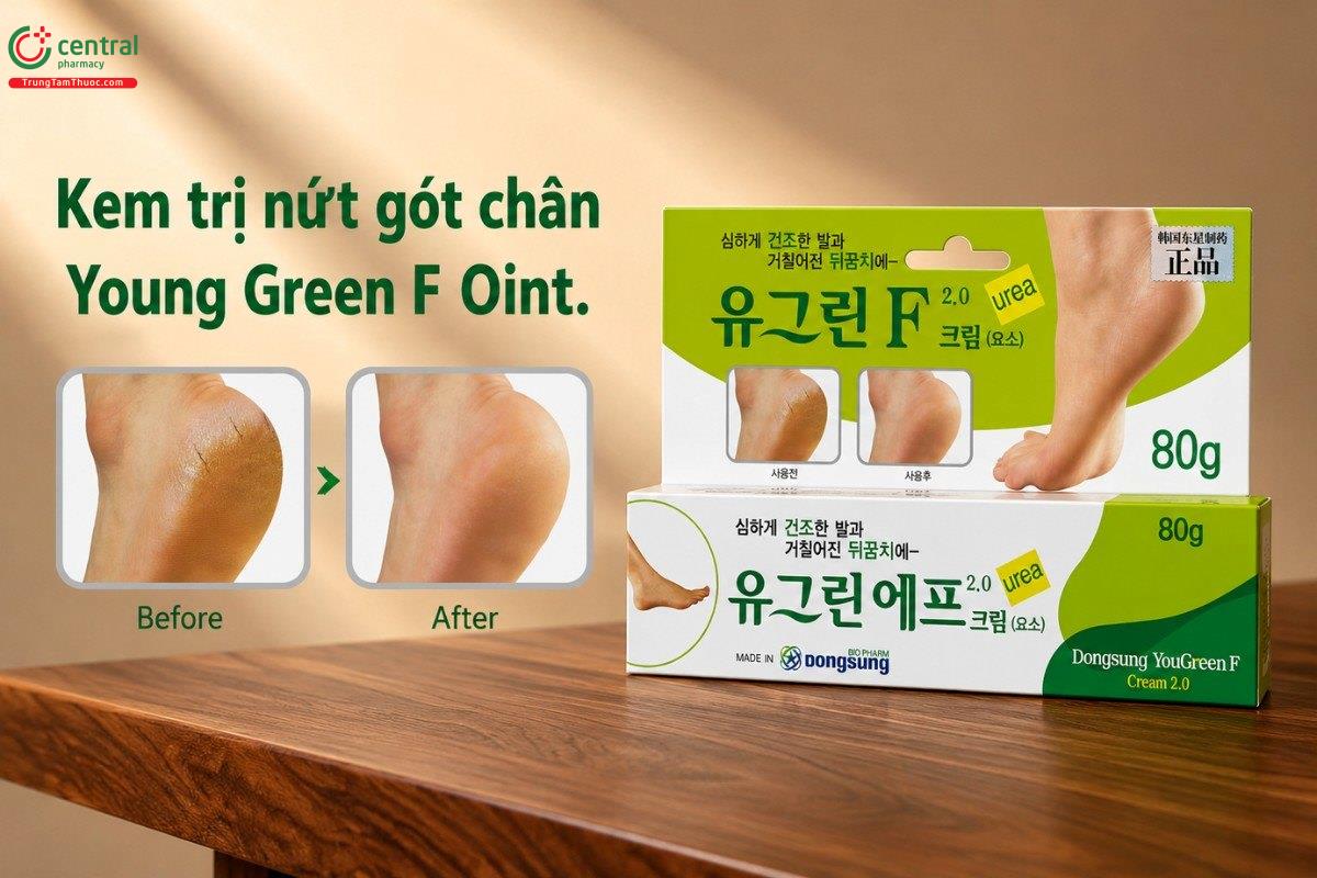 Kem trị nứt, chai sần gót chân Hàn Quốc Young Green F Oint.
