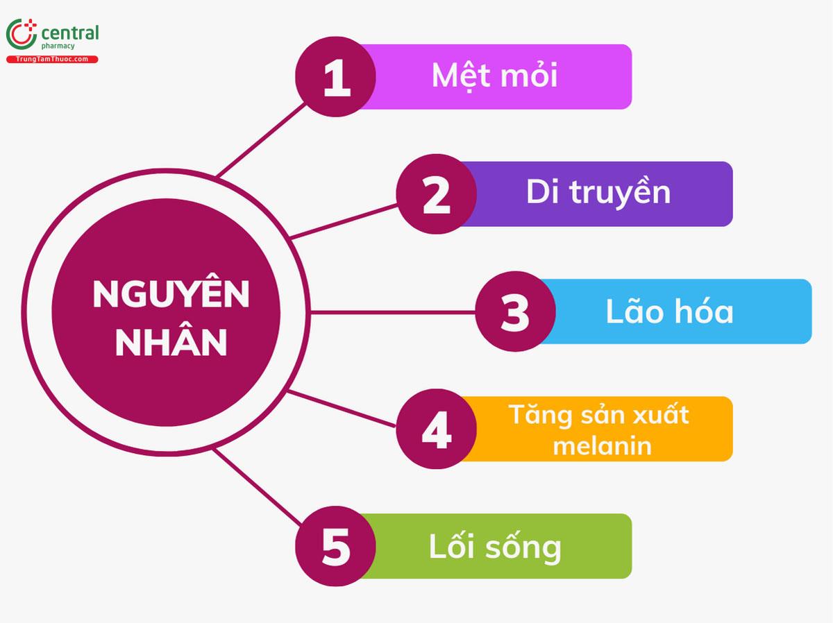 Nguyên nhân gây ra quầng thâm dưới mắt