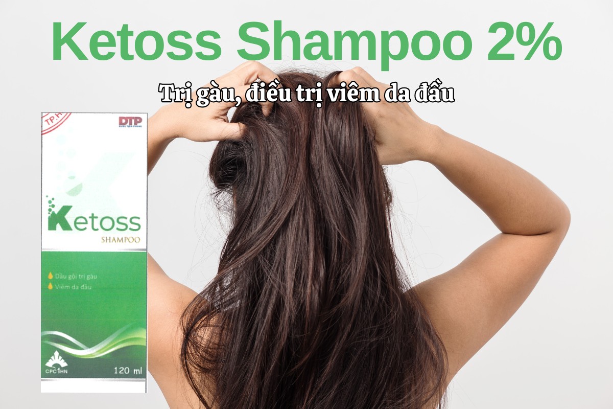 Thuốc Ketoss Shampoo 2% điều trị và dự phòng nhiễm nấm men