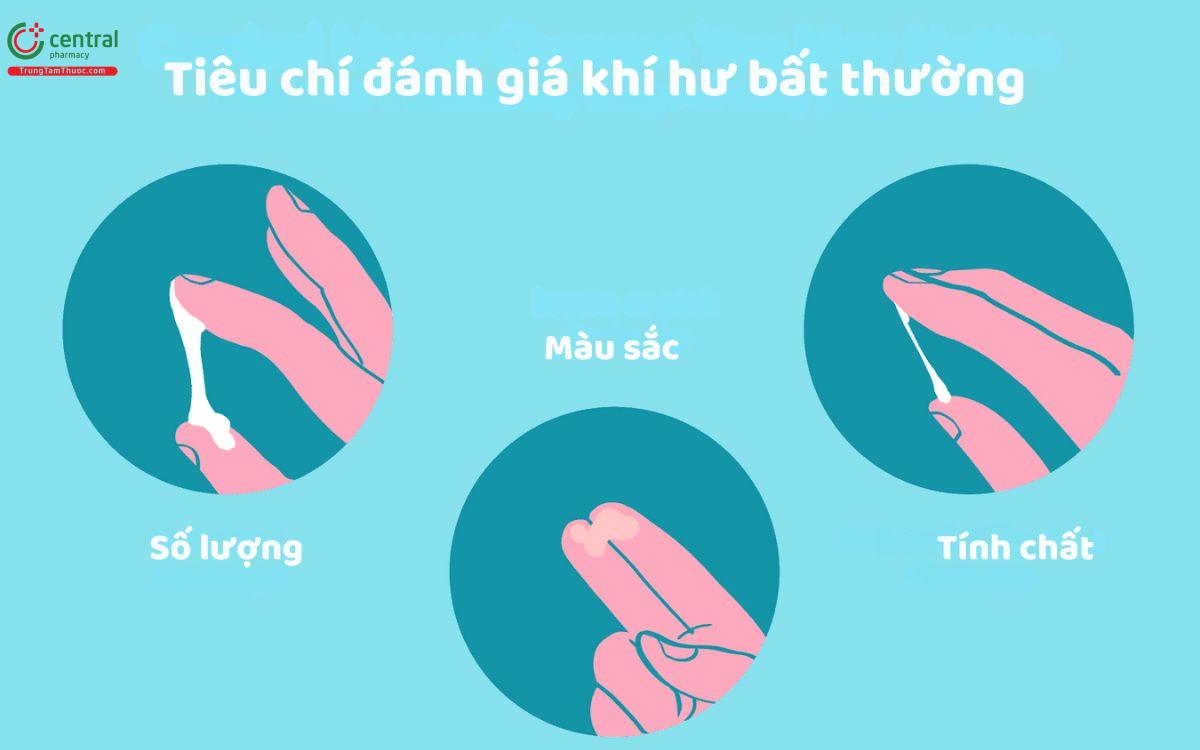 Phân biệt khí hư bình thường và bất thường