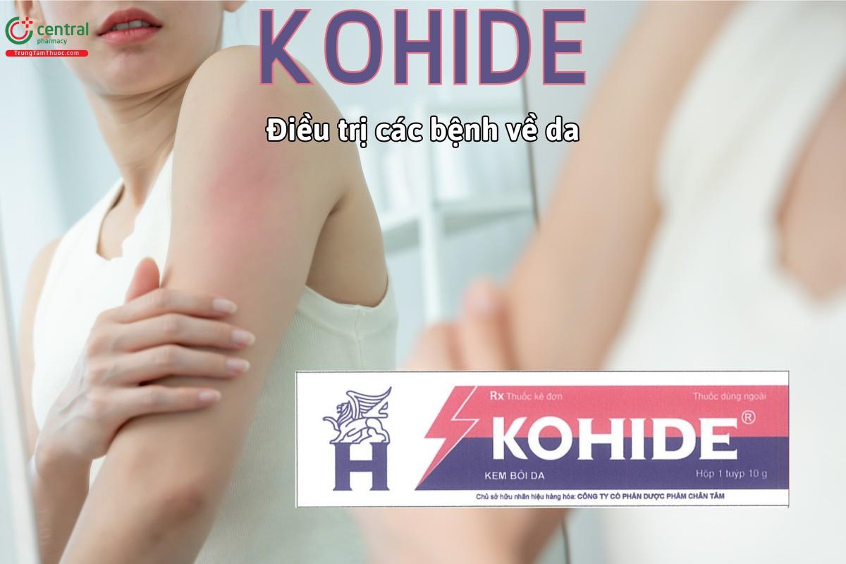 Thuốc Kohide điều trị các bệnh ngoài da có đáp ứng với corticosteroid