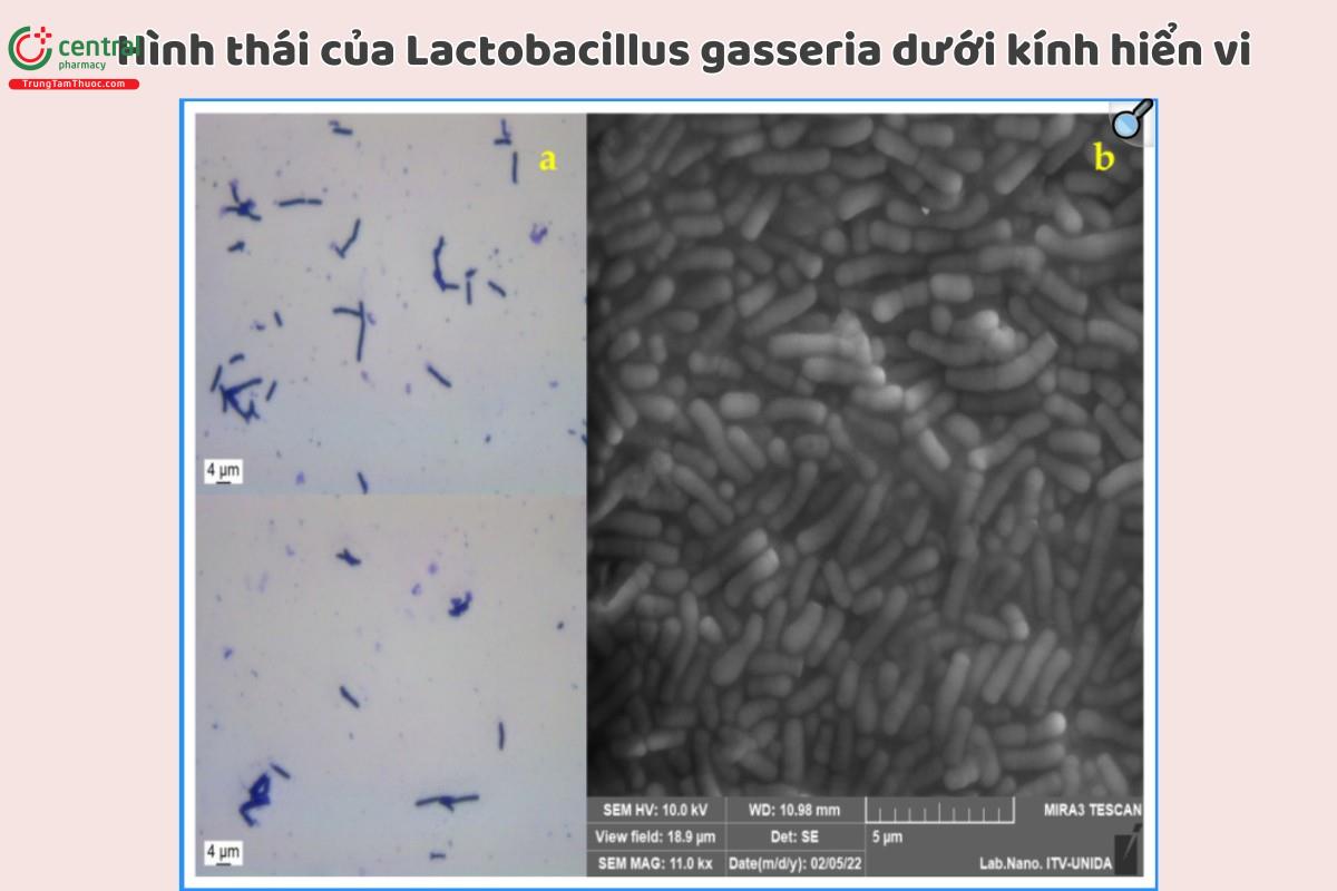 Hình thái của Lactobacillus gasseria dưới kính hiển vi