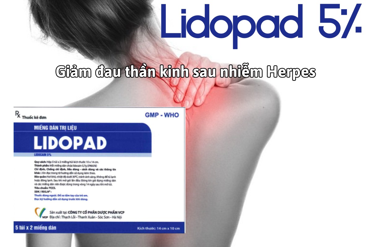Thuốc Lidopad 5% giảm các triệu chứng đau thần kinh sau nhiễm Herpes zoster