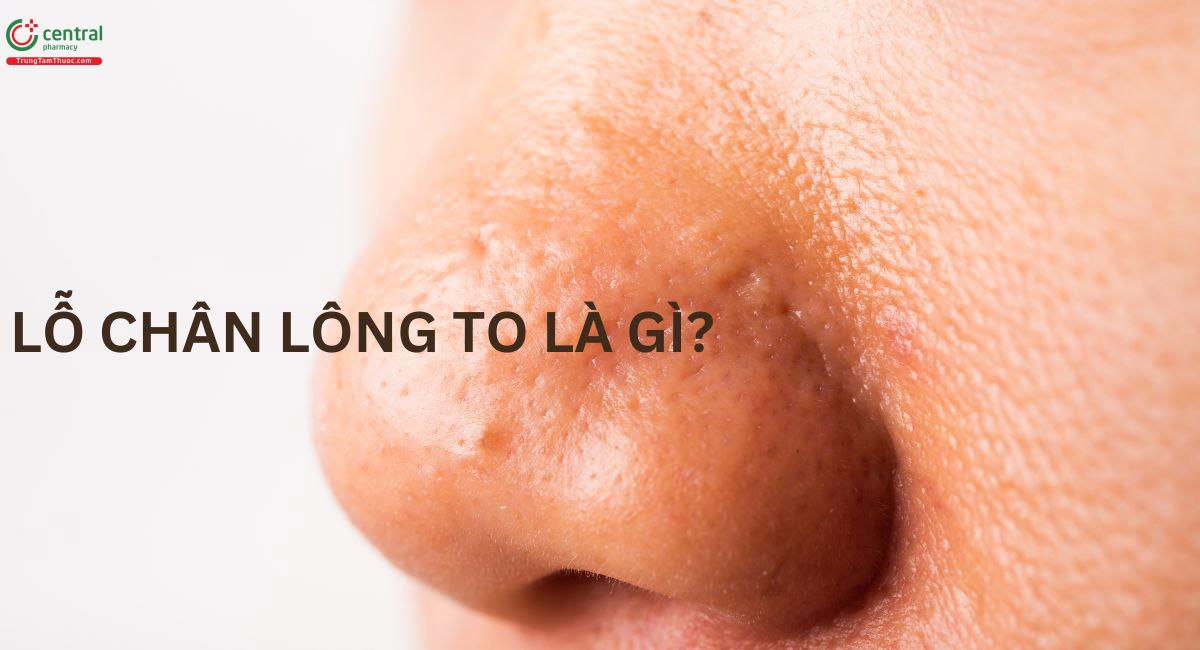 Lỗ chân lông to là gì?