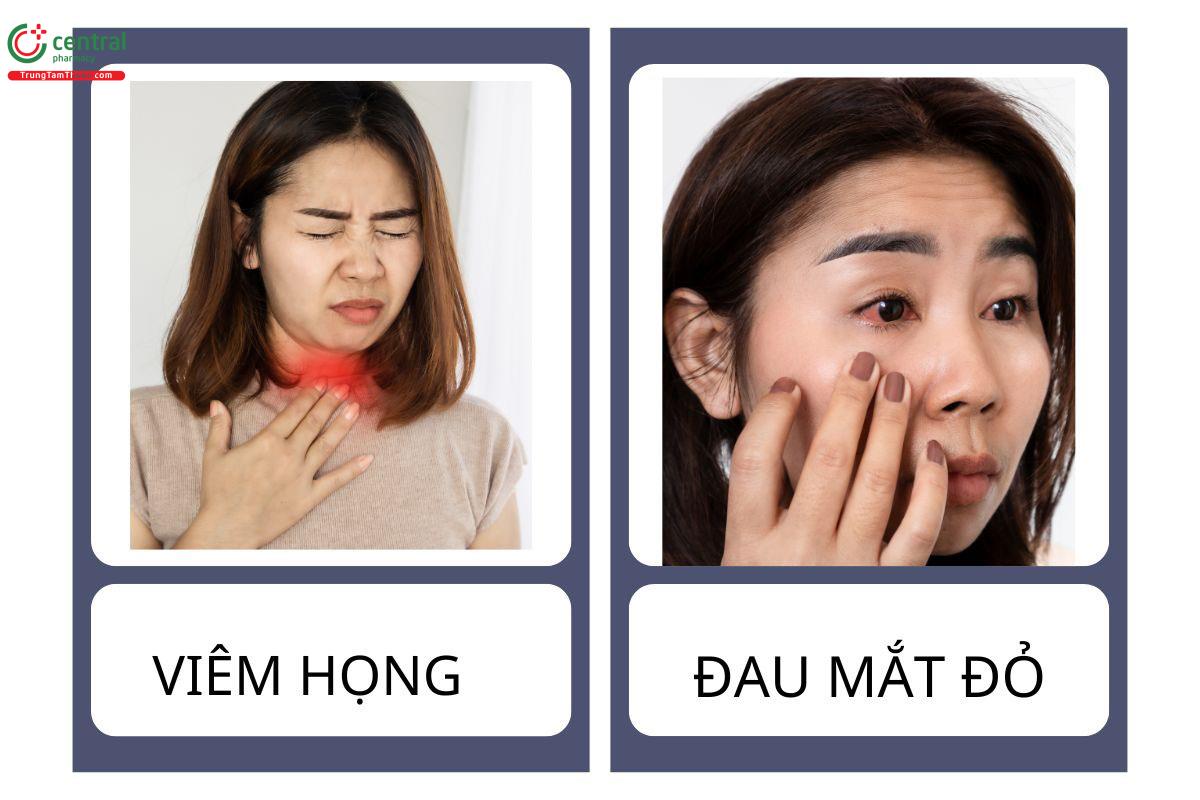 Mật cá trắm có tác dụng gì?