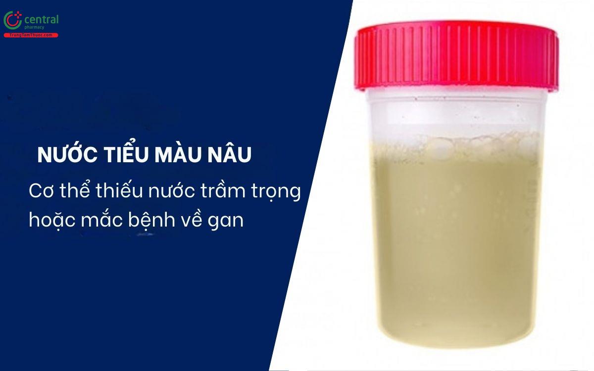 Nước tiểu màu nâu