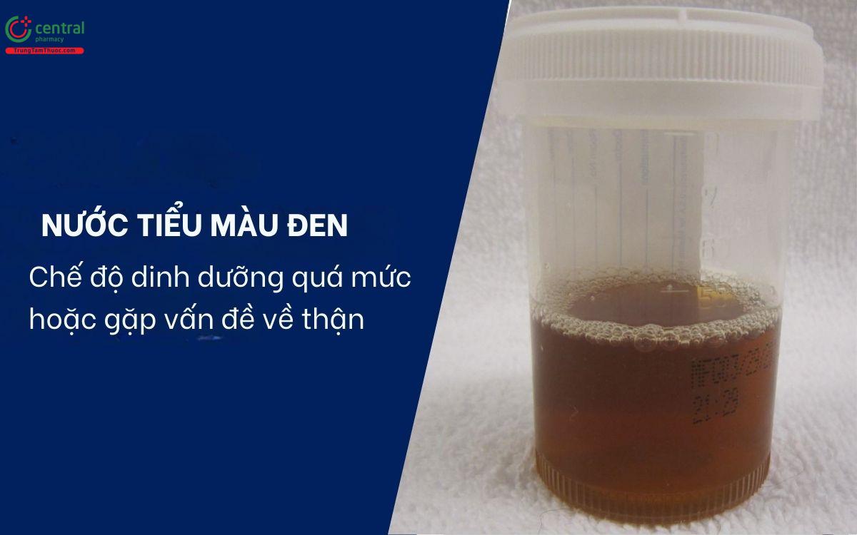 Nước tiểu màu tím hoặc đen