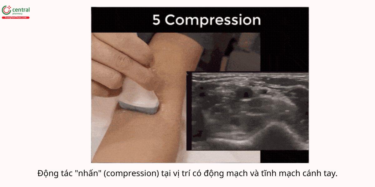 Động tác "nhấn" (Compression)