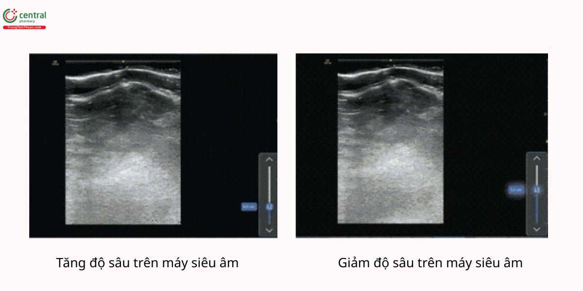 Tăng và giảm độ sâu trên máy siêu âm