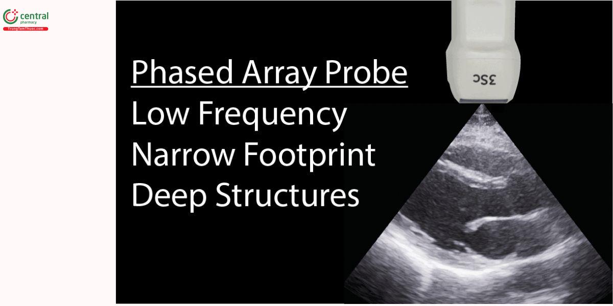 Đầu dò "phased array": tần số thấp, diện tiếp xúc hẹp, khảo sát cấu trúc sâu.